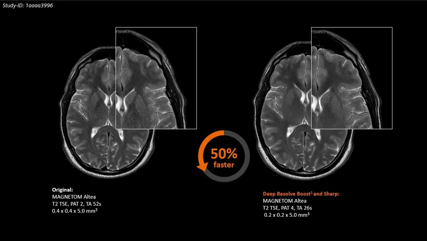 MAGNETOM Altea features and benefits