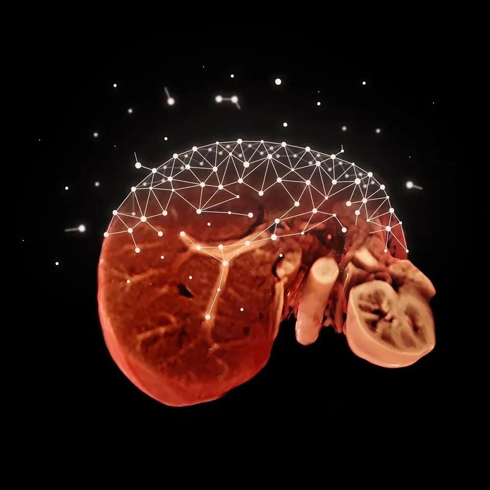 3T MRI scanner MAGNETOM Vida