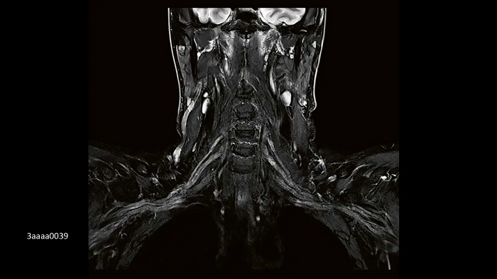 3T MRI scanner MAGNETOM Vida