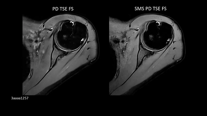 3T MRI scanner MAGNETOM Vida