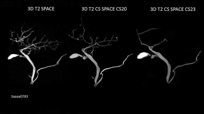 3T MRI scanner MAGNETOM Vida