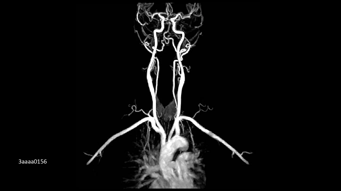 3T MRI scanner MAGNETOM Vida