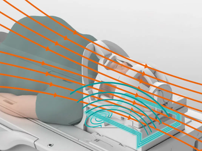 BioMatrix Tuners. CoilShim and SliceAdjust locally adapt to specific patient anatomy and thereby deliver excellent image quality, fat saturation and homogeneity