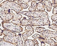 Immunochemical staining of human ACVR2B in human placenta.