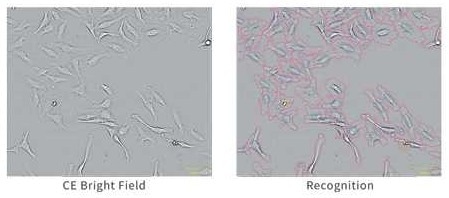 Optimizing cell imaging processes with CellPathfinder