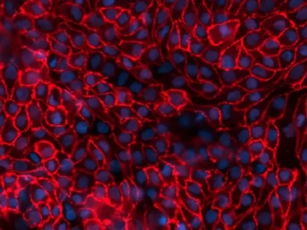 Cross-species comparison of drug handling with near-physiological kidney transporter model