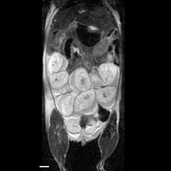 T2-weighted images show mouse placenta and fetal development during pregnancy.