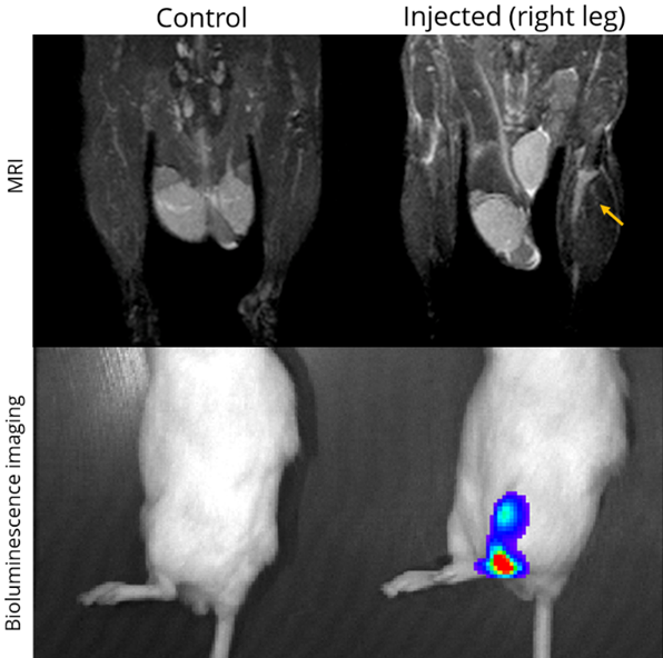 MRI is a complementary method to bioluminescence imaging in the detection of tumors allowing more precise assessment of the location and extent of orthotopic tumors (here an orthotopic model of prostate bone marrow metastasis).