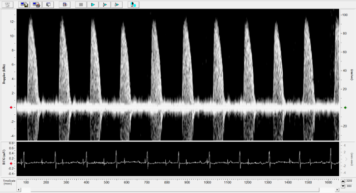 Mouse - Ascending Aorta