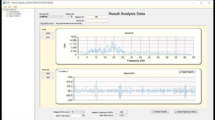 Tremor monitor system