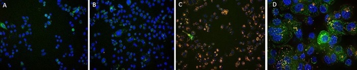 SK-BR-3 cells were treated with CellLights Lysosome GFP (green) for 16 hours followed by treatment with Anti-Her2 Abs-Internalization Detection Reagent conjugate and IgG1 Isotype-Internalization Detection Reagent conjugate separately for 16 hours (red), then stained with NucBlue Live ReadyProbes(blue) for 20 minutes and imaged on the EVOS M7000. A. Antibody Internalization Detection Reagent (Cat.No.IGG-PZF2001). B. IgG1 Isotype-Internalization Detection Reagent conjugate. C. Anti-Her2 Abs-Internalization Detection Reagent conjugate. D. Anti-Her2 Abs-Internalization Detection Reagent conjugate(Z-stacking)
