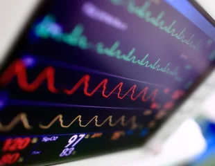 Kinetic fluorescence analysis for the determination of vitamin B