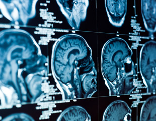 The World Orphan Drug Congress Europe heads to Amsterdam for the first time, uniting experts and leaders from rare disease research, patient advocacy, biotech, and pharma to make this the must-attend R&D event in Europe