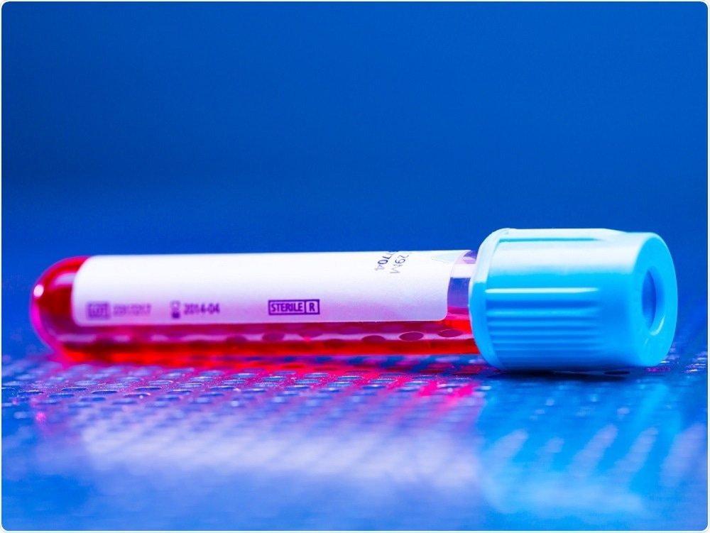 Photo of sample to be tested