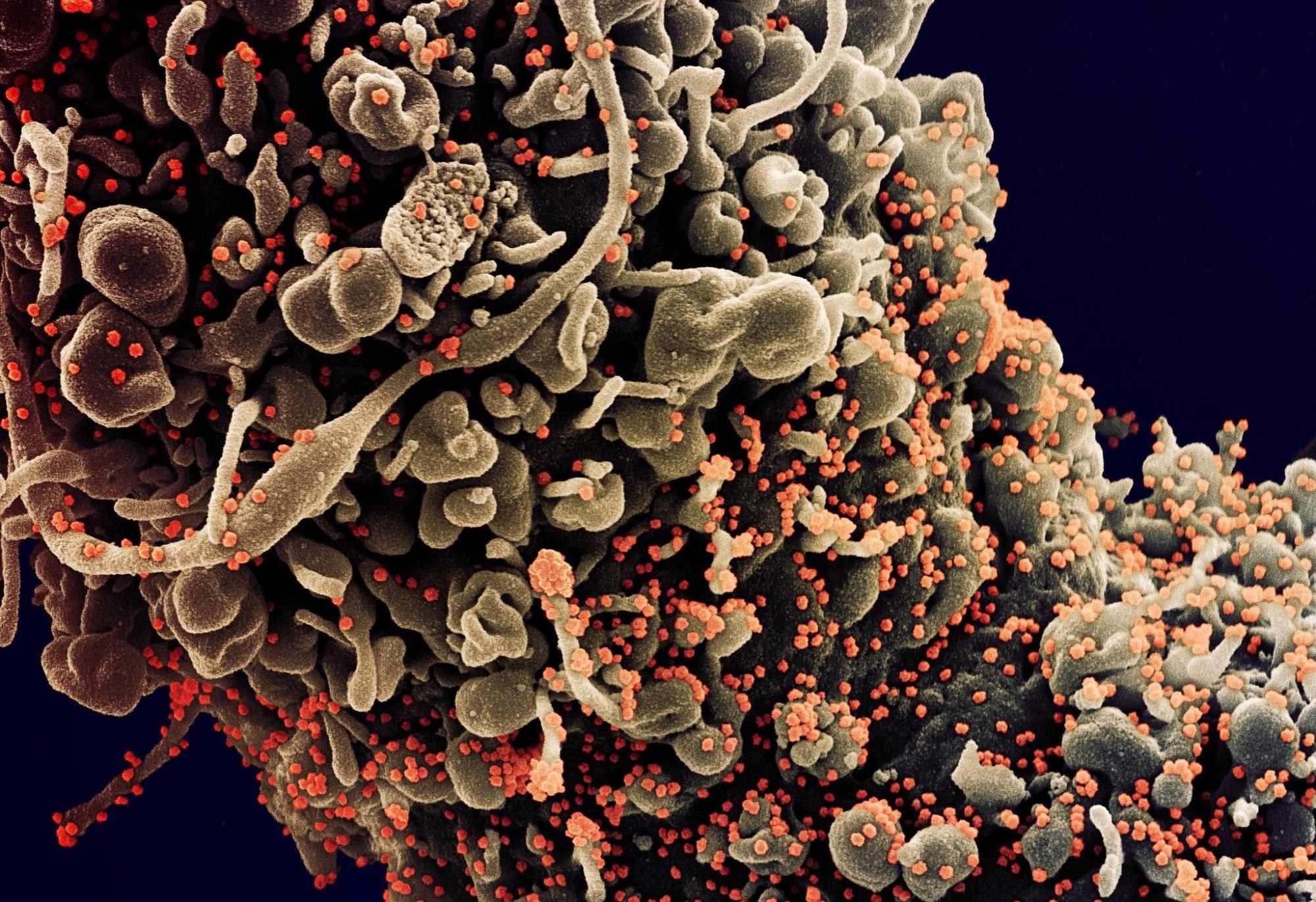 Study: Landscapes and dynamic diversifications of B-cell receptor repertoires in COVID-19 patients. Image Credit: NIAID