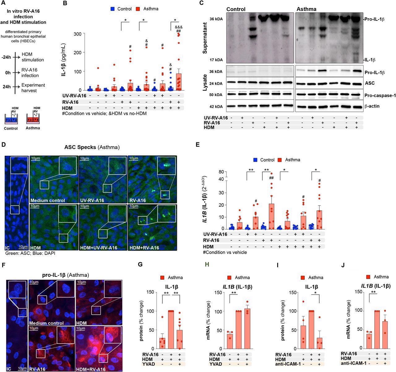 House dust mite increased rhinovirus-induced inflammasome activation in human bronchial epithelium in asthma A) Experimental model overview. Primary air liquid interface (ALI)-differentiated human bronchial epithelial cells (HBECs) from control individuals and patients with asthma were treated with house dust mite (HDM) (200 μg/mL) or vehicle for 24h, followed by an infection with rhinovirus A16 (RV-A16) or UV-treated (UV)-RV-A16 in the multiplicity of infection (MOI) 0.1 for 24h. B) IL-1β release to the apical compartment assessed by ELISA (control
