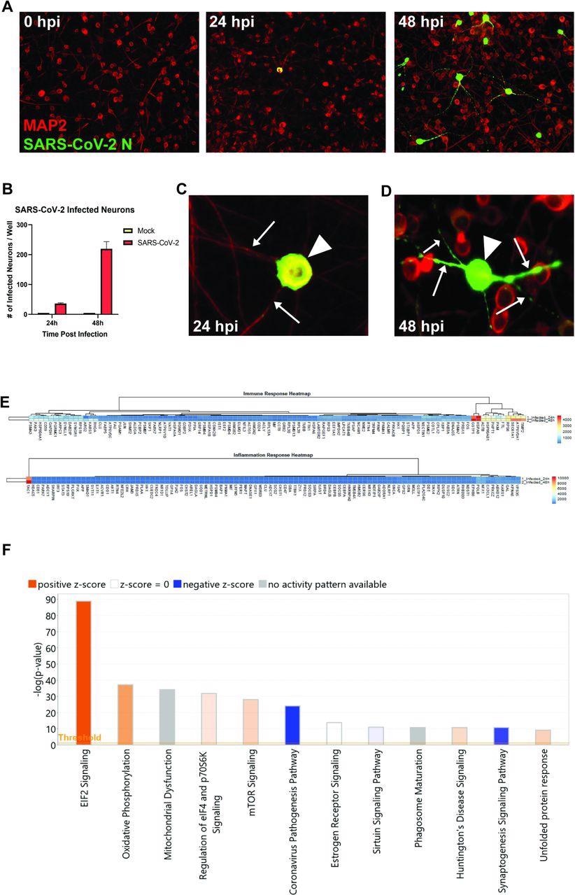 SARS-CoV-2 infects human iPSC-derived neurons. (A) hiPSC-derived neurons were infected with SARS-CoV-2 at an MOI of 0.1, immunostained with anti-MAP2 and anti-SARS-CoV-2 N, and imaged at 0, 24, and 48 hours post-infection. (B) Quantification of SARS-CoV-2 GFP fluorescence of mock-infected and SARS-CoV-2-infected hiPSC-derived neurons. (C) Perinuclear replication of SARS-CoV-2 in neuronal soma (arrowhead) but no viral axonal (arrows) transport at 24 hours post-infection. (D) Perinuclear presence of SARS-CoV-2 in soma (arrowhead) and axon (arrows) at 24 hours post-infection. (E) Heat map of genes expressed 24 and 48h post-infection. (F) Top 12 canonical pathways showing progressive changes from 24 to 48 h post-infection.