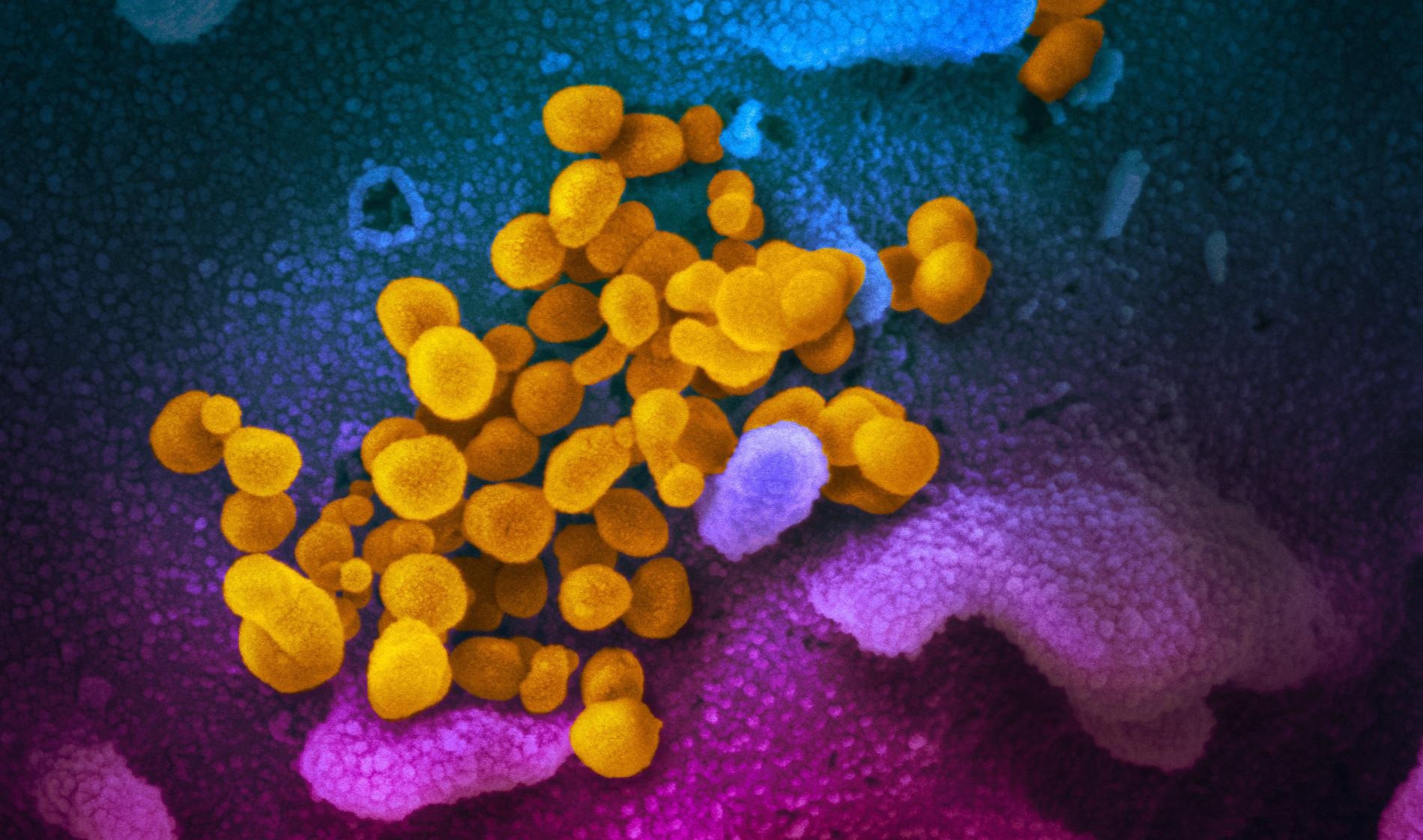 Study: Inferring effects of mutations on SARS-CoV-2 transmission from genomic surveillance data. Image Credit: NIAID
