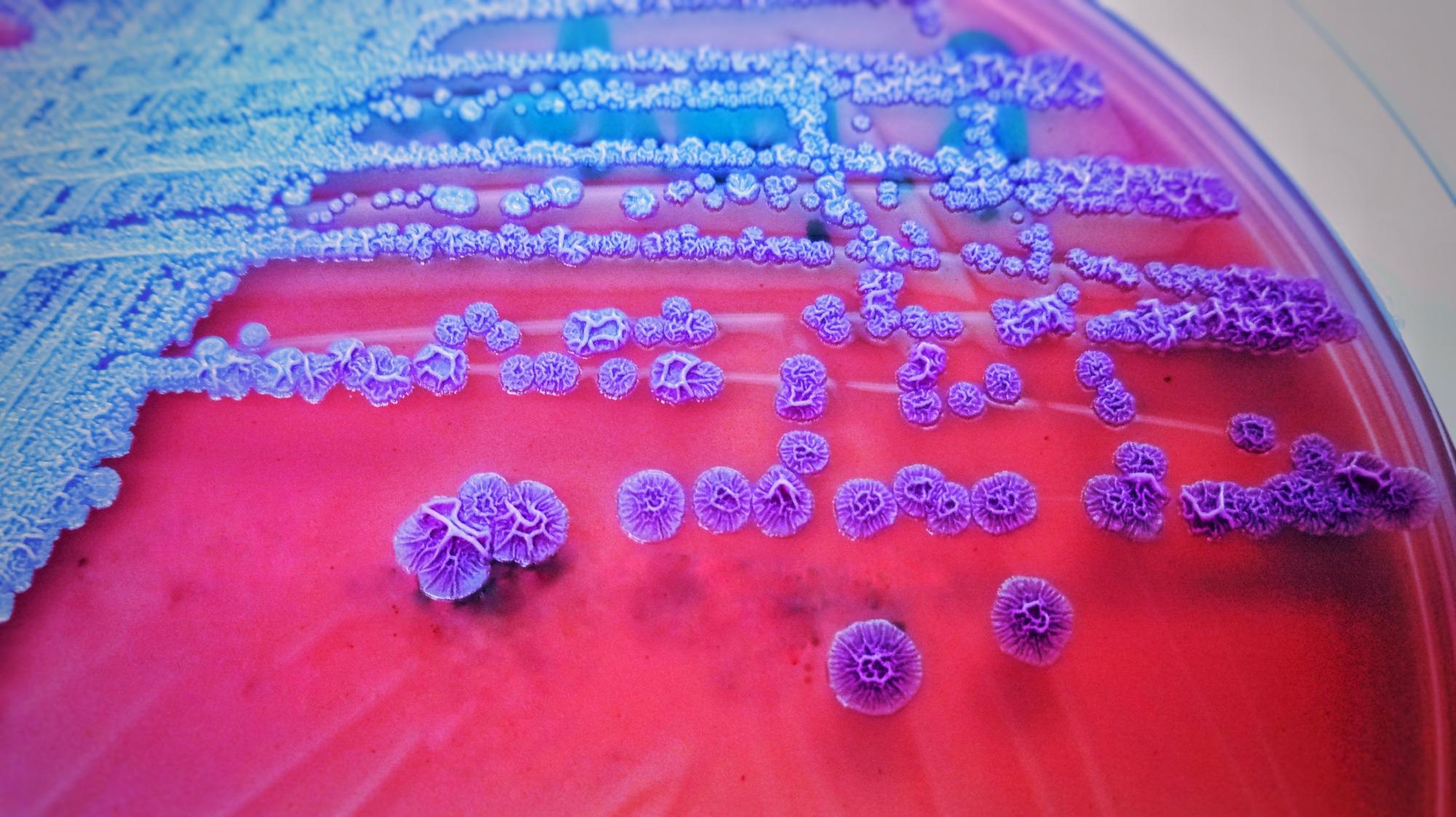 Study: Global burden of bacterial antimicrobial resistance in 2019: a systematic analysis. Image Credit: TheBlueHydrangea / Shutterstock