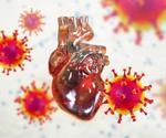Study suggests people with COVID-19 exhibit increased risks and 12-month burdens of incident cardiovascular diseases