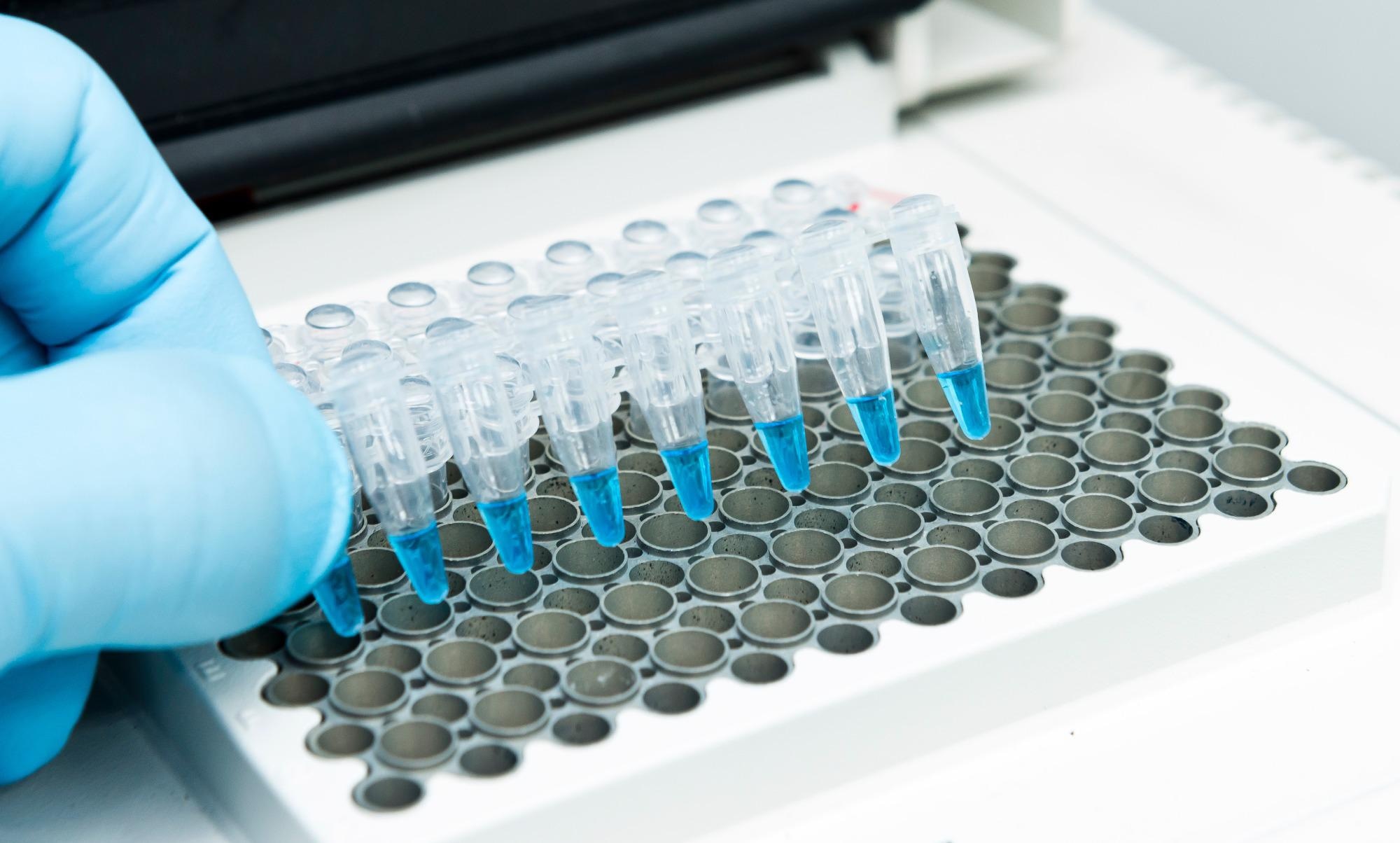 Study: Crippled Coronavirus: 5′-PolyU targeted Oligo prevents development of infectious Virions. Image Credit: unoL / Shutterstock