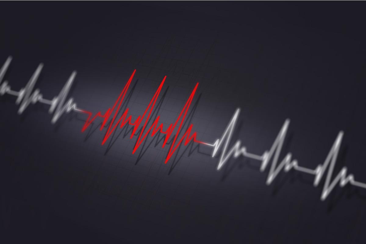 Study: High frequency and persistence of Anti-DSG2 antibodies in post COVID-19 serum samples. Image Credit: alexaldo/Shutterstock