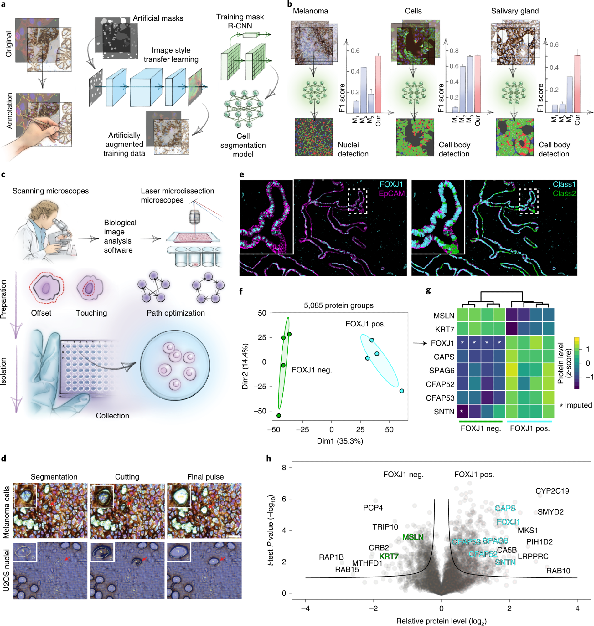 a, AI-driven nucleus and cytoplasm segmentation of normal-appearing and cancer cells and tissue using BIAS. b, We benchmarked the accuracy of its segmentation approach using the F1 metric and compared results to three additional methods—M1 is unet4nuclei6, M2 is CellProfiler8 and M3 is Cellpose7—while OUR refers to nucleAIzer3. Bars show mean F1 scores with s.e.m.; n = 10 independent images for melanoma tissue and (U2OS) cells, and n = 20 for salivary gland tissue. Visual representation of the segmentation results: green areas correspond to true positive, blue to false positive and red to false negative. c, BIAS serves as the interface between the scanning and an LMD microscope, allowing high-accuracy transfers of cell contours between the microscopes. Illustration of cutting offset with respect to the object of interest and optimal path finding. d, Practical illustration of the functions in the upper panel. e, Immunofluorescence staining of the human fallopian tube epithelium with FOXJ1 and EpCAM antibodies, detecting ciliated and epithelial cells, respectively. Left panel: Ciliated (FOXJ1-positive) and secretory (FOXJ1-negative) cells. Right panel: Cell classification based on FOXJ1 intensity. Class 1 (FOXJ1-positive) and class 2 (FOXJ1-negative); magnification factor = ×387. f, PCA of FOXJ1-positive and FOXJ1-negative cell proteomes. g, Heat map of known protein markers for secretory and ciliated cells. Protein levels are z-scored. Asterisks represent imputed data. The marker list was derived from the Human Protein Atlas20 project and based on literature mining. h, Volcano plot of the pairwise proteomic comparison between FOXJ1-positive and FOXJ1-negative cells. Cell-type-specific marker proteins are highlighted in green and turquoise, and black represents potential novel marker proteins. Significant enriched cell-type-specific proteins are displayed above the black lines (two-sided t-test, FDR < 0.05, s0 = 0.1, n = 4 biological replicates