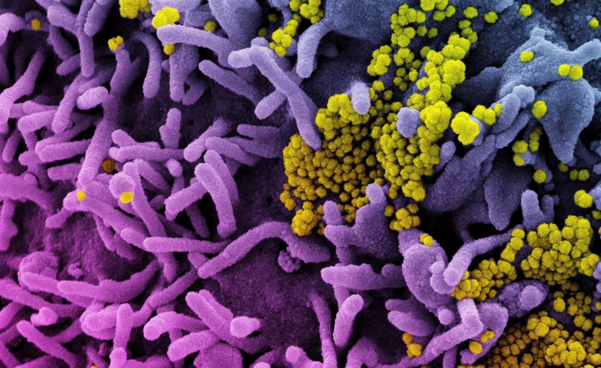 Study: SARS-CoV-2 minor variant genomes at the start of the pandemic contained markers of VoCs. Image Credit: NIAID