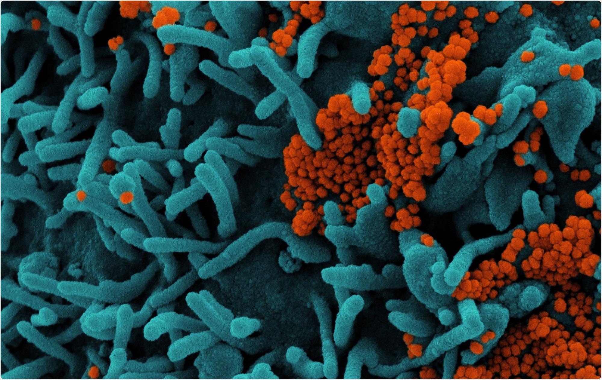 Study: Immunosuppression as a hub for SARS-CoV-2 mutational drift. Image Credit: NIAID