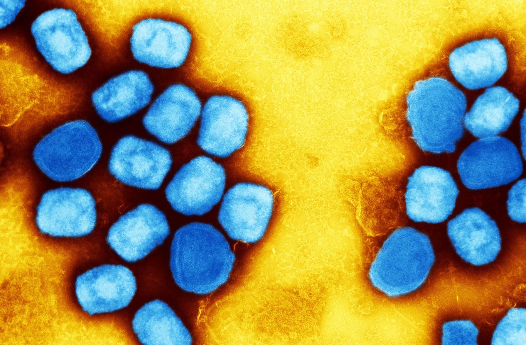 Study: Vaccinia-Virus-Based Vaccines Are Expected to Elicit Highly Cross-Reactive Immunity to the 2022 Monkeypox Virus. Image Credit: NIAID