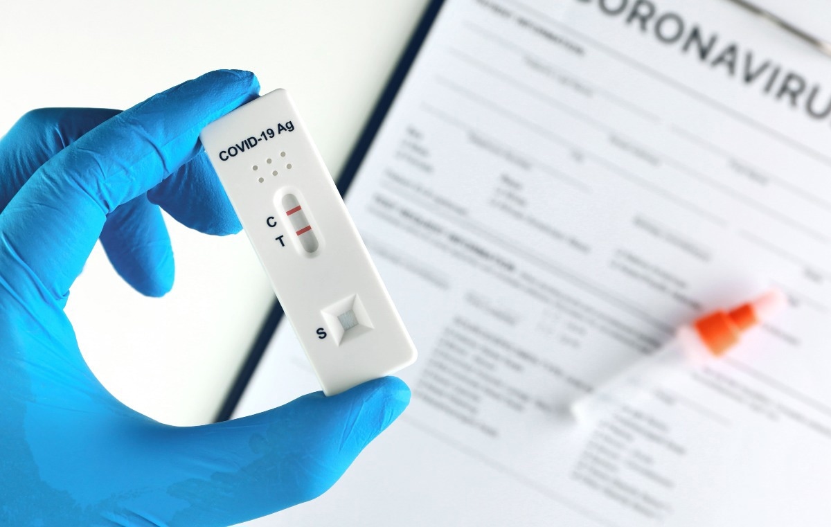 Study: Deep mutational scanning identifies SARS-CoV-2 Nucleocapsid escape mutations of currently available rapid antigen tests. Image Credit: eakasarn/Shutterstock