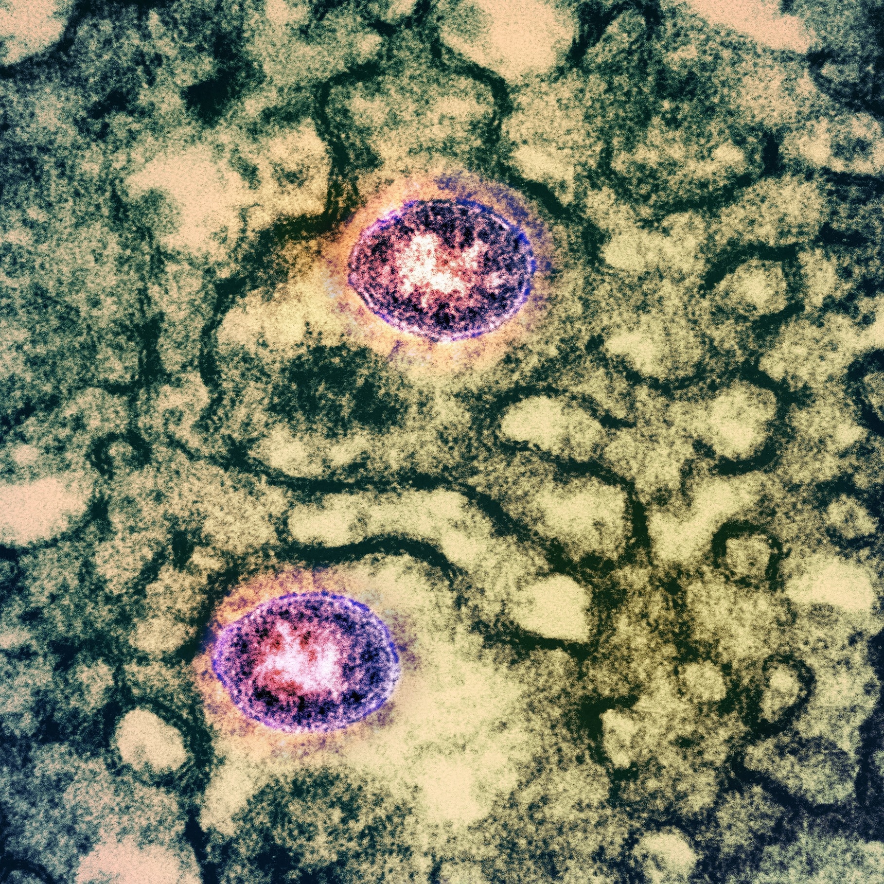 Study: O-Linked Sialoglycans Modulate the Proteolysis of SARS-CoV-2 Spike and Contribute to the Mutational Trajectory in Variants of Concern. Image Credit: NIAID