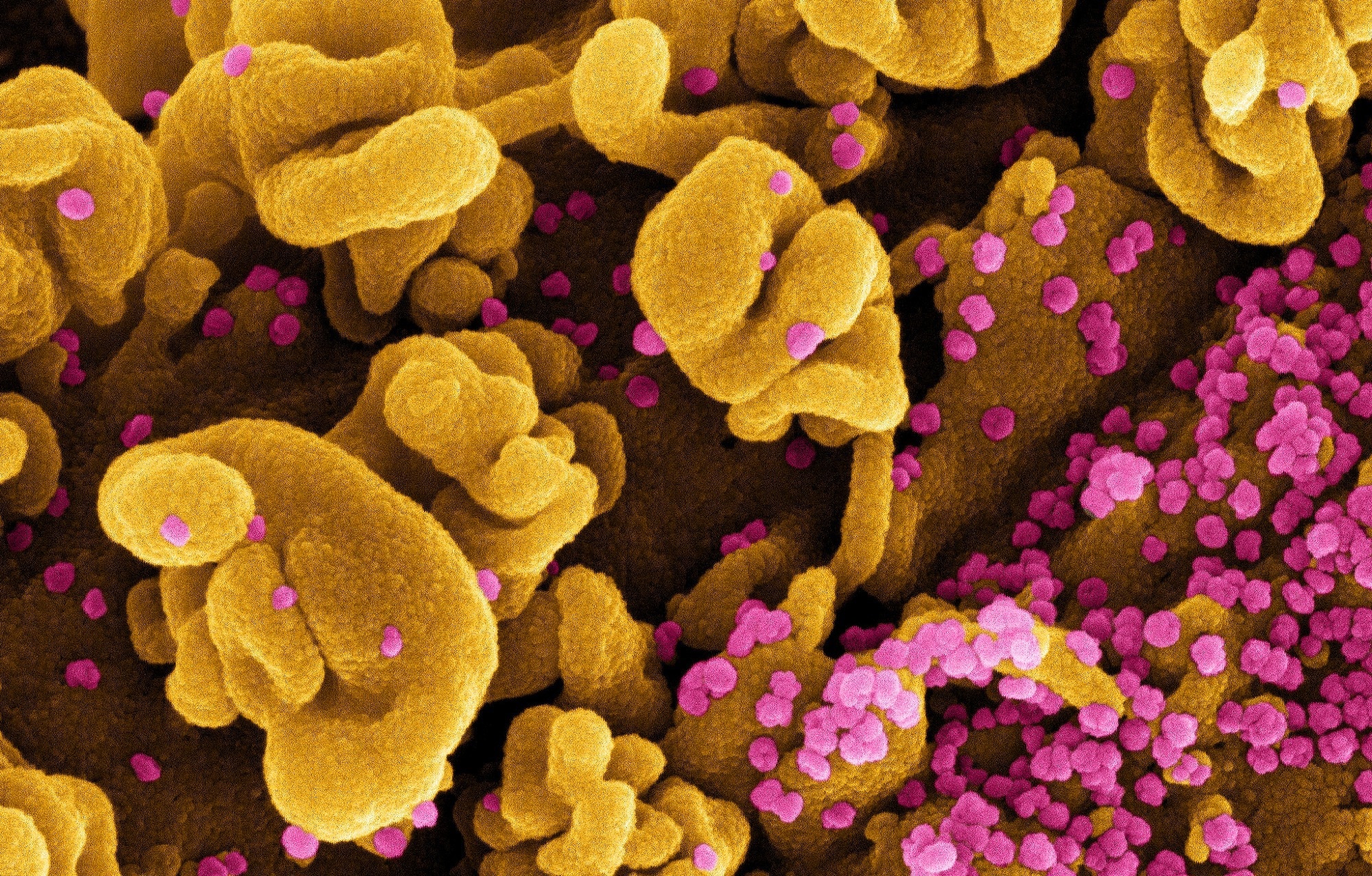 Study: Increased vaccine sensitivity of an emerging SARS-CoV-2 variant. Image Credit: NIAID