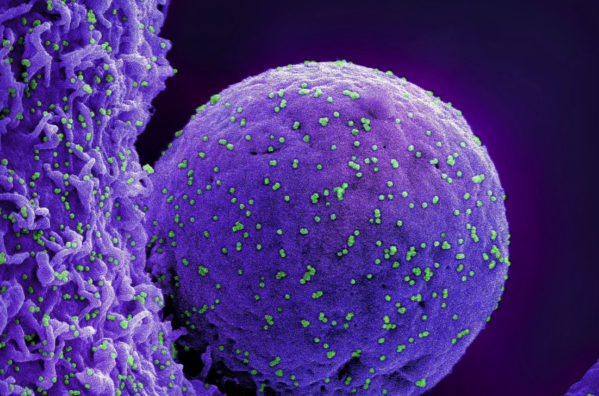 Study: SARS-CoV-2 Infection Biomarkers Reveal an Extended RSAD2 Dependant Metabolic Pathway. Image Credit: NIAID