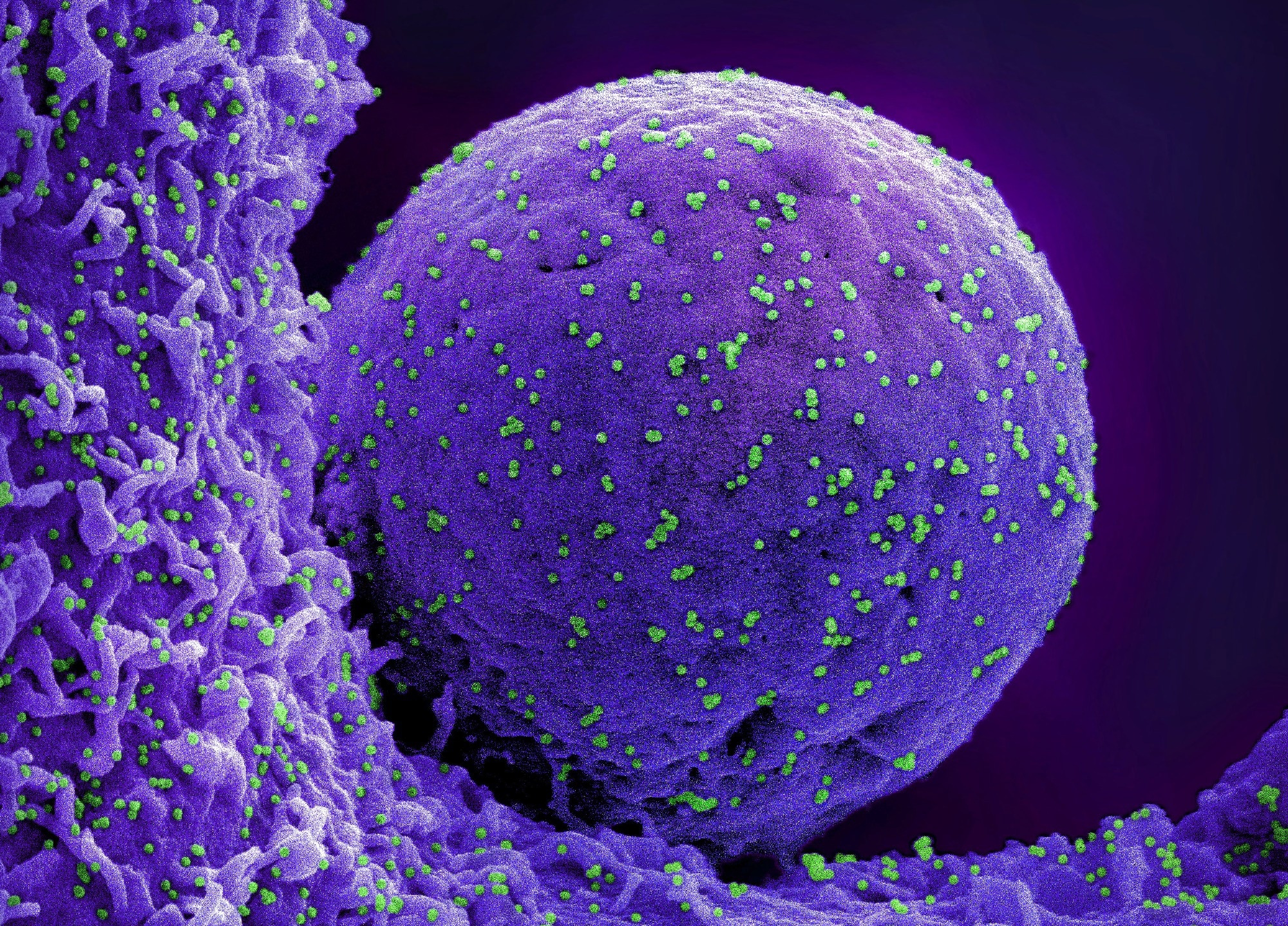 Study: SARS-CoV-2 hijacks fragile X mental retardation proteins for efficient infection. Image Credit: NIAID