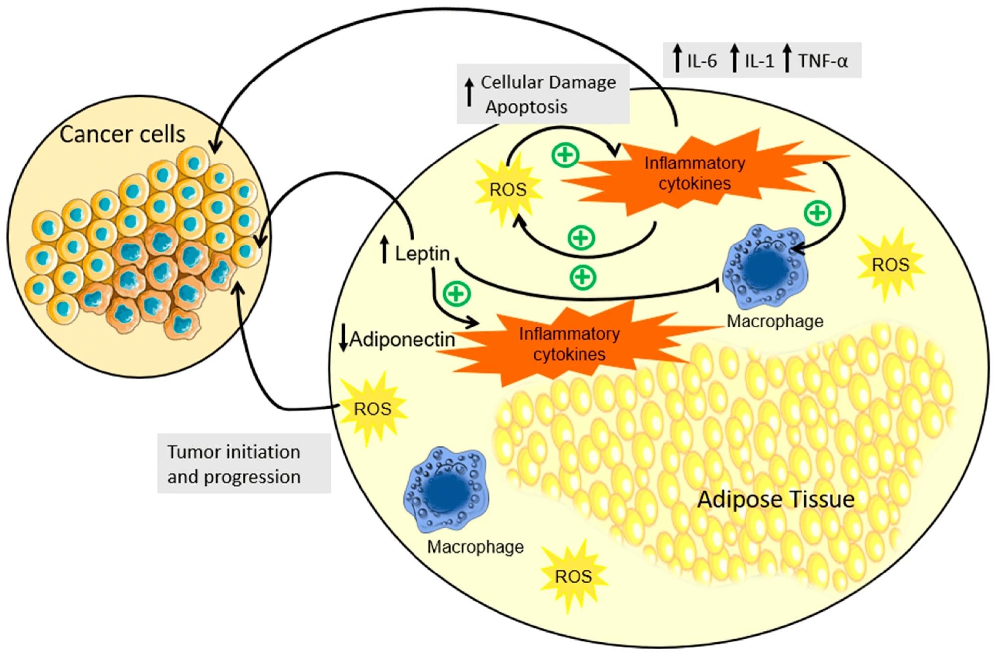 Schematic representation of inflammation, hormonal dysregulation, and OS in the adipose tissue due to obesity. In individuals with obesity, a notable expansion of adipose tissue triggers an aberrant production and secretion of cytokines, accompanied by the disruption of adipokine regulation. This cascade instigates a series of interconnected events: cytokines foster heightened ROS production, inciting apoptosis, which then exacerbates cytokine release, perpetuating a self-perpetuating cycle. This cytokine orchestration not only contributes to the perpetuation of low-grade chronic inflammation but also significantly augments the landscape for tumor development. Concurrently, elevated leptin levels in obesity correlate with heightened inflammatory cytokine levels, fostering an environment conducive to both the initiation and progression of tumors. In contrast, the diminished presence of adiponectin compounds the scenario, offering a conducive milieu for tumor development. In summary, the complex interplay between obesity, cytokine dynamics, and adipokine regulation unveils a multifaceted process that intricately contributes to chronic inflammation and the initiation and advancement of tumorigenesis. (↓) downregulation; (↑) upregulation; (+) promotion.