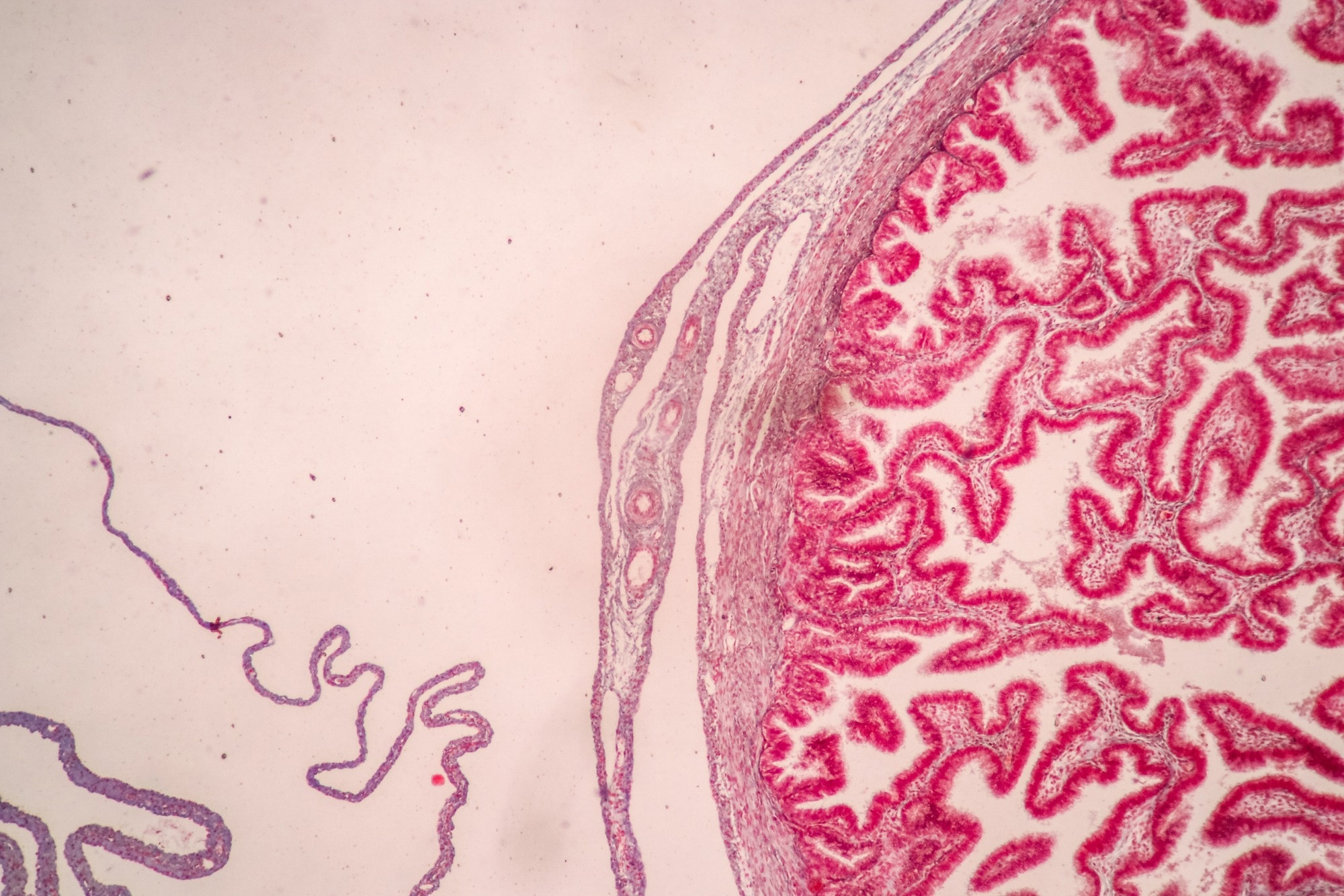 Study: Placental Streptococcus agalactiae DNA is associated with neonatal unit admission and foetal pro-inflammatory cytokines in term infants. Image Credit: Rattiya Thongdumhyu/Shutterstock.com