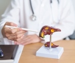 Study finds key gene deletion shields mice from diet-induced obesity and liver disease