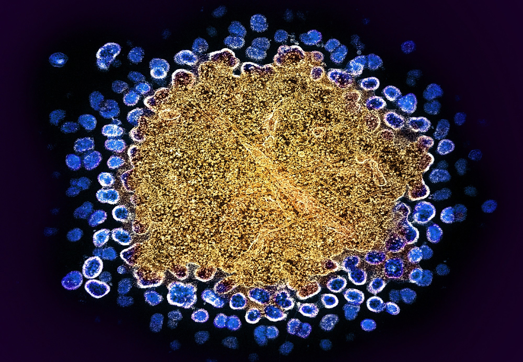 Study: SAMD9L acts as an antiviral factor against HIV-1 and primate lentiviruses by restricting viral and cellular translation. Image Credit: NIAID