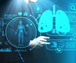 AI model accurately estimates pulmonary function from chest x-rays