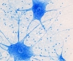 The Key Role of iPSC-Derived Microglia in Research and Drug Discovery