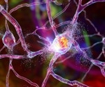 Researchers develop the first polymer-based therapeutic for Huntington’s disease