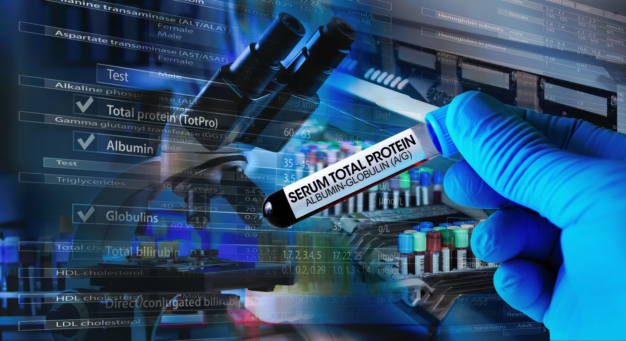 Study: Atlas of the plasma proteome in health and disease in 53,026 adults. Image Credit: angellodeco / Shutterstock