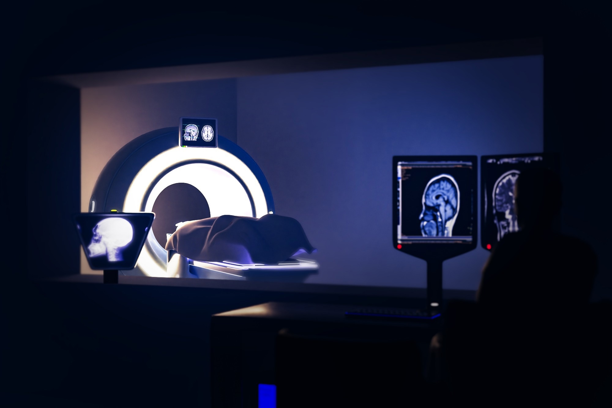 Study: Projected Lifetime Cancer Risks From Current Computed Tomography Imaging. Image Credit: Radiological imaging / Shutterstock