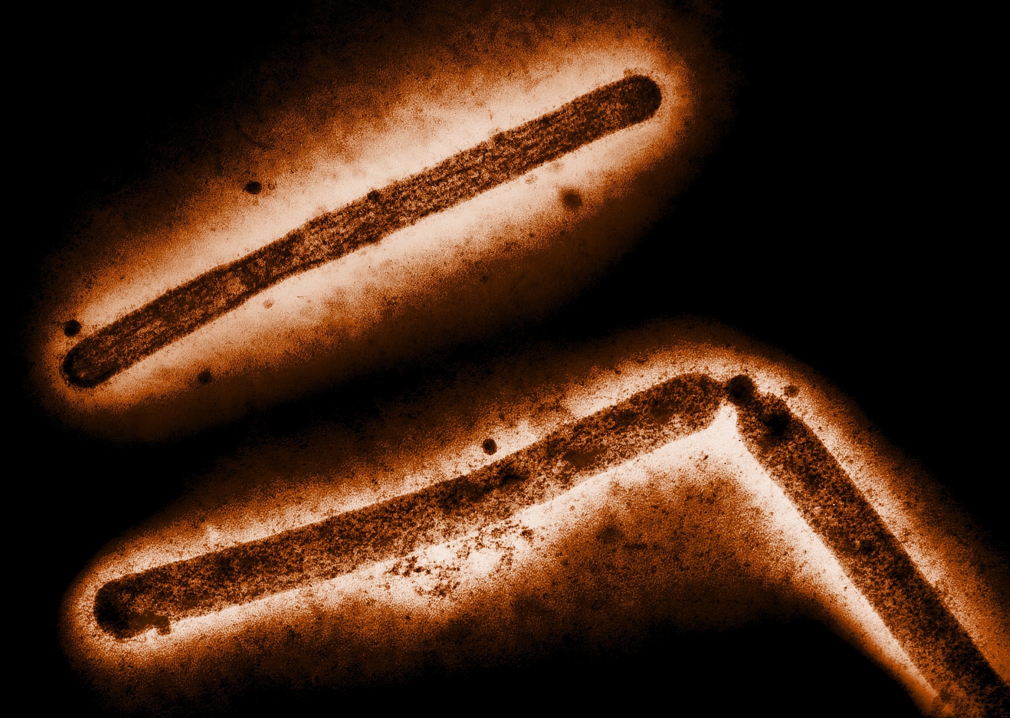 Three influenza A (H5N1/bird flu) virus particles (rod-shaped). Note: Layout incorporates two CDC transmission electron micrographs that have been inverted, repositioned, and colorized by NIAID. Scale has been modified. Image Credit: CDC and NIAID