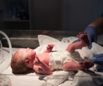 High-dose vitamin D strengthens bones in very low birth weight infants