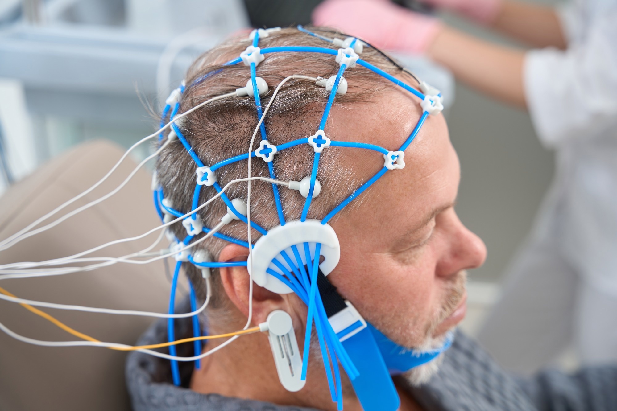 Patient undergoing an EEG encephalography diagnostic procedure