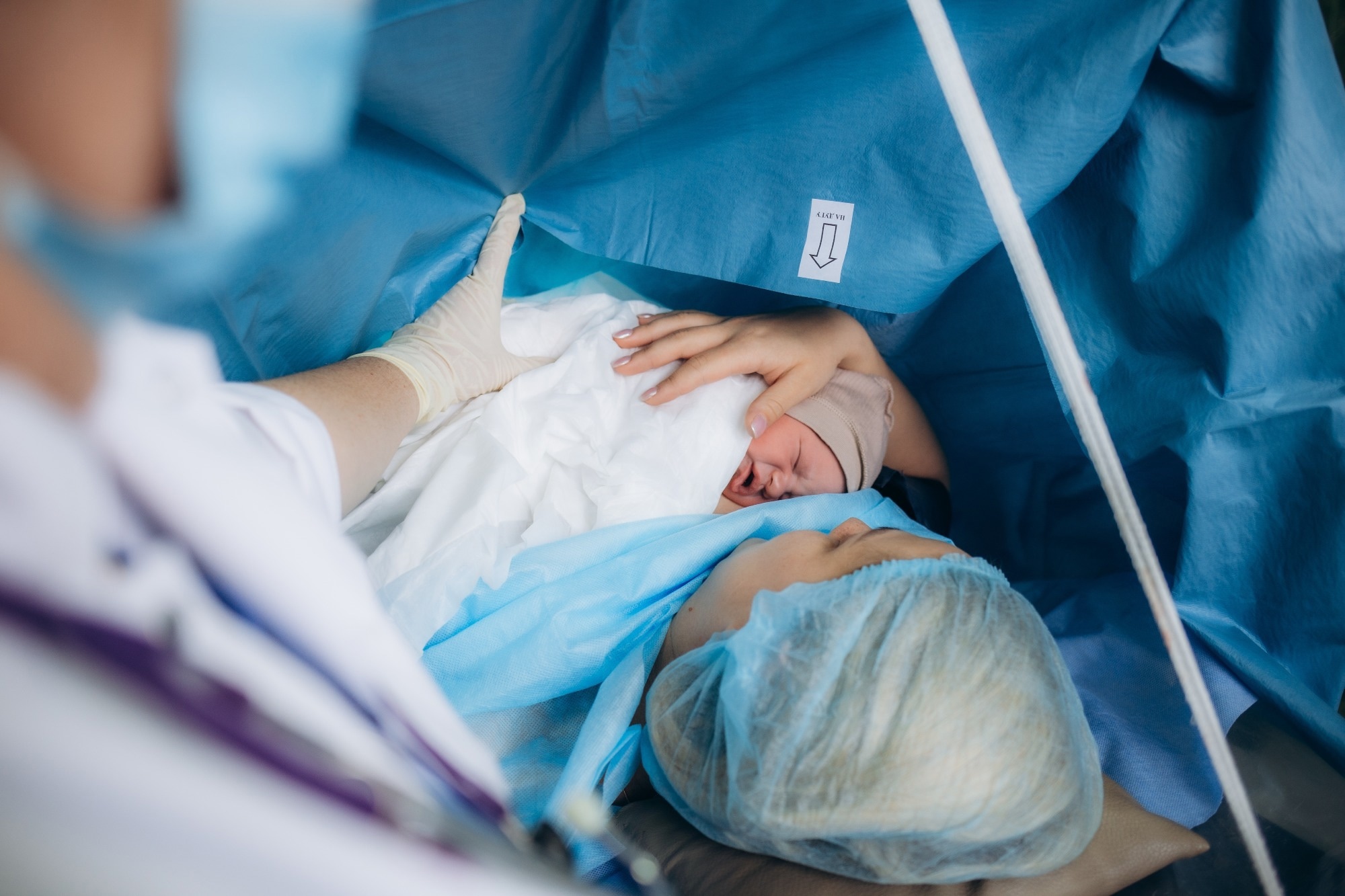 Study: Association of cesarean section with asthma and atopic dermatitis in infants from the Japan Environment and Children’s Study. Image Credit: Roman Fenton / Shutterstock