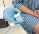 New federal guidelines shift cervical cancer screening to HPV testing