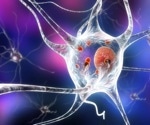 Researchers have identified a possible cause of an inherited form of Parkinson's disease